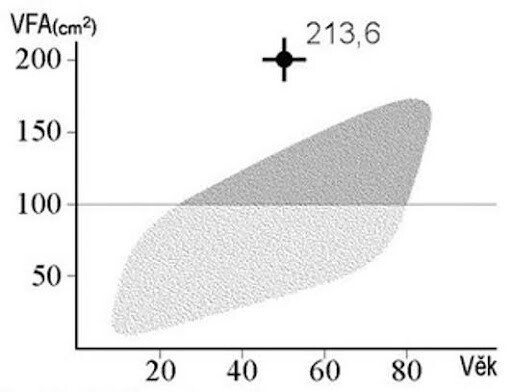 Grafické znázornění viscerálního tuku ve výsledkovém listu InBody.